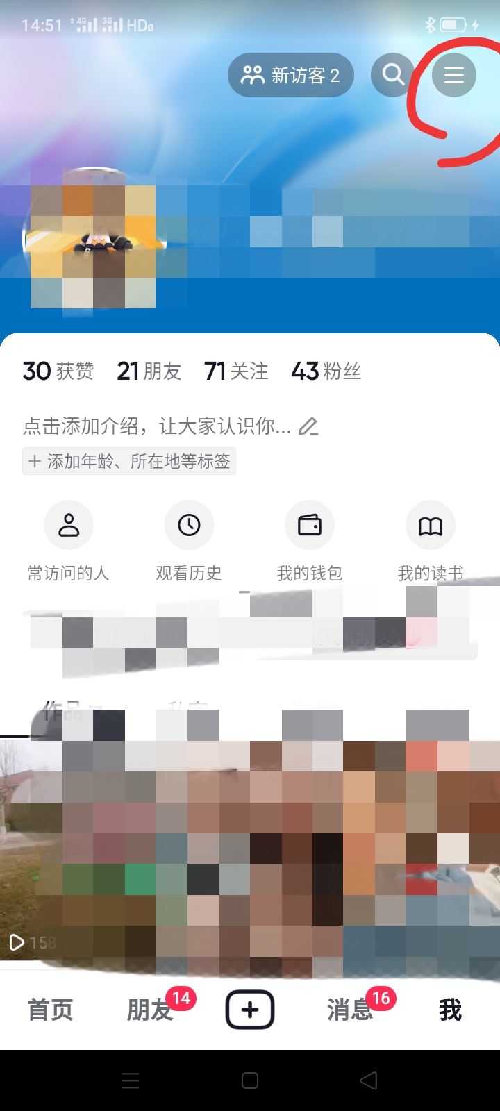 抖音?？吹娜嗽趺搓P掉關注提示？